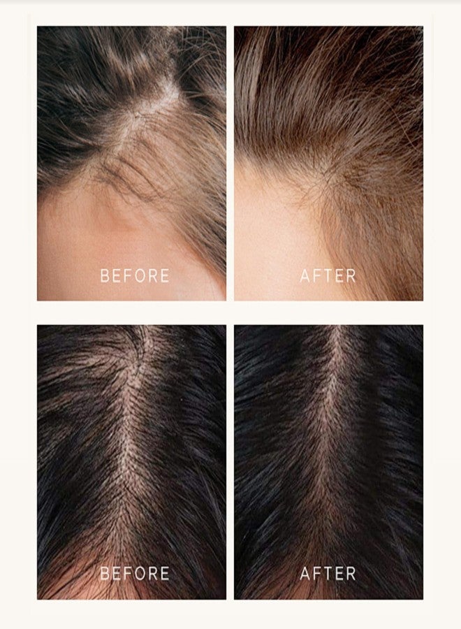 GROEI Scalp Hair Growth Serum for Thinning Hair – Niacinamide & Panthenol Formula for Stronger-Looking Strands: Lightweight Daily Scalp Treatment for Men & Women, 20ml (2PCS) - Image 5